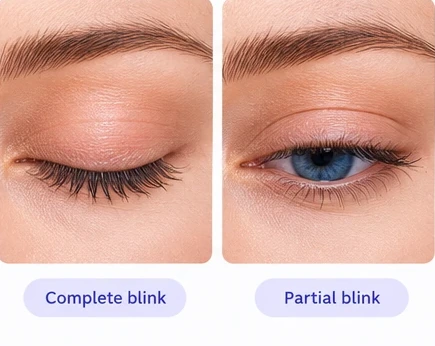A complete blink beside a partial blink that leaves the lower eye uncovered